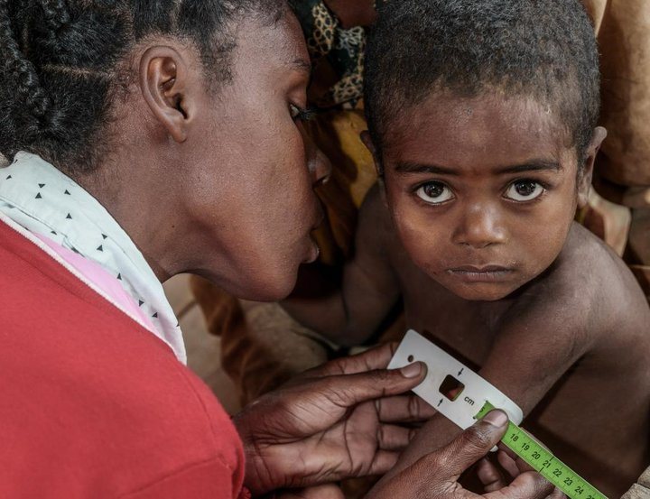 Mara litla í lækisskoðun. Hún var orðin vannærð en er nú hægt og bítandi að ná vopnum sínum með aðstoð lækna og hjúkrunarfræðinga.