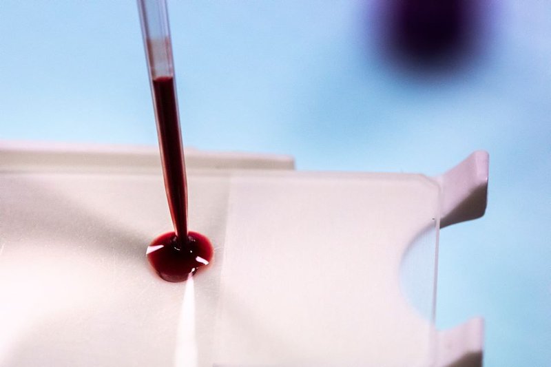 Áfram verður unnið að mótefnarannsóknum þar til besta aðferðin finnst. Mynd: Þorkell Þorkelsson/Landspítalinn