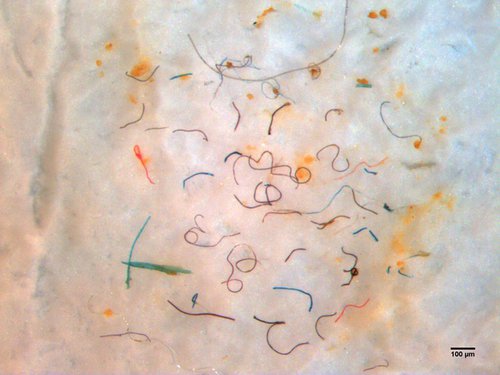 Á myndinni má sjá plastþræði sem finna mátti í einu sýni sem tekið var í byrjun maí 2018. Mynd:Biopol