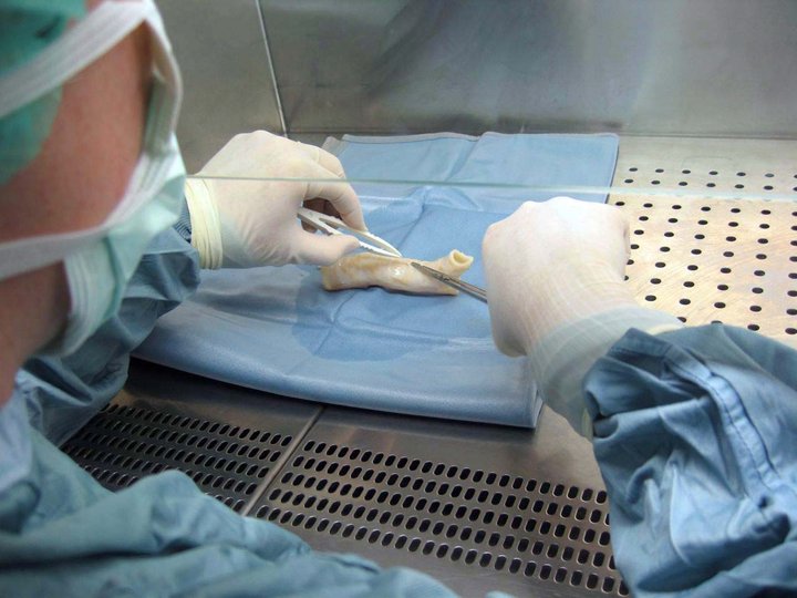 Gervibarki græddur í manneskju.