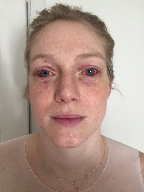 Myndin var tekin fjórum dögum eftir fæðingu.